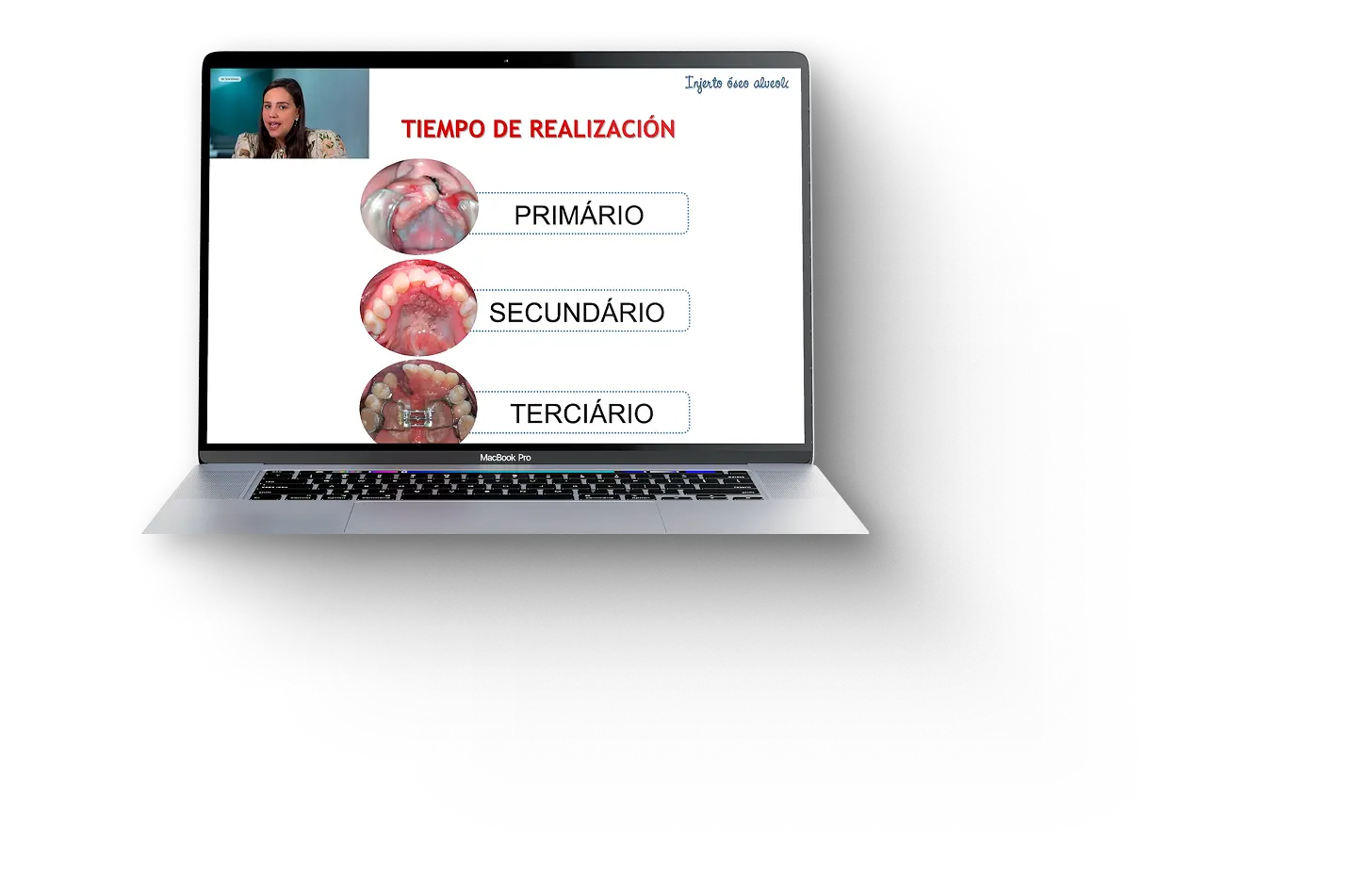 Módulo extra Fisuras labiopalatinas