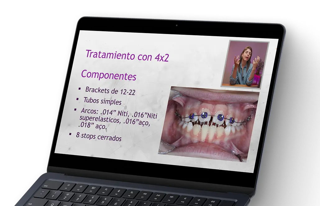 Clase sobre la técnica 4x2 y dobleces
